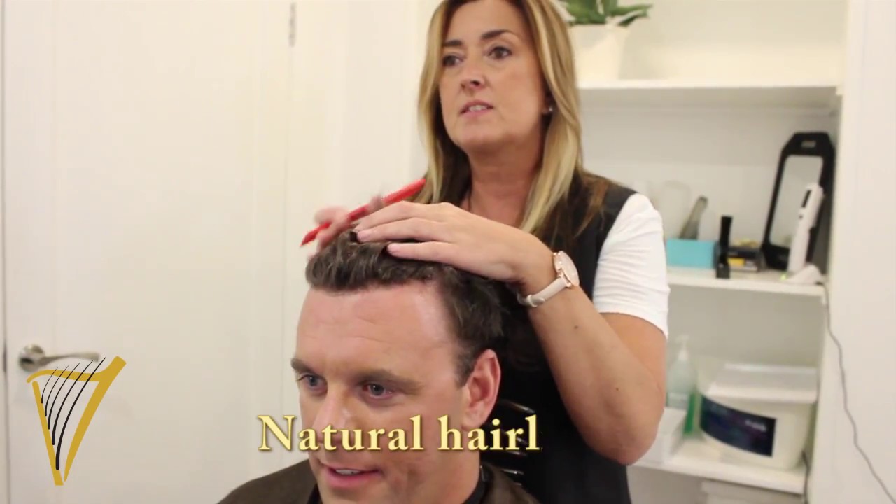 Latest In Hair Replacement Systems Premier Hair Restoration Clinic Latest In Hair Replacement Systems Premier Hair Restoration Clinic